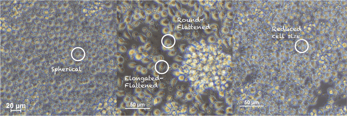 Understanding these dynamics is crucial for developing strategies to sustain T cell functionality. One effective approach is to create environments that mimic natural activation, providing refined and prolonged stimulation. This helps prevent over-exhaustion by gradually activating T cells, similar to marathon training, ultimately preserving T cell potency while minimizing exhaustion risk.