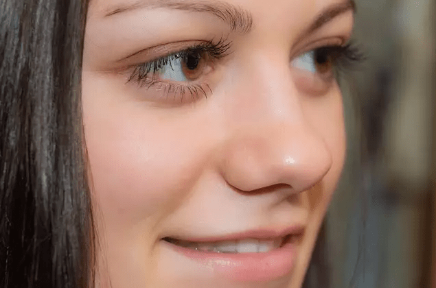 Nếp nhăn ở mắt khi cười