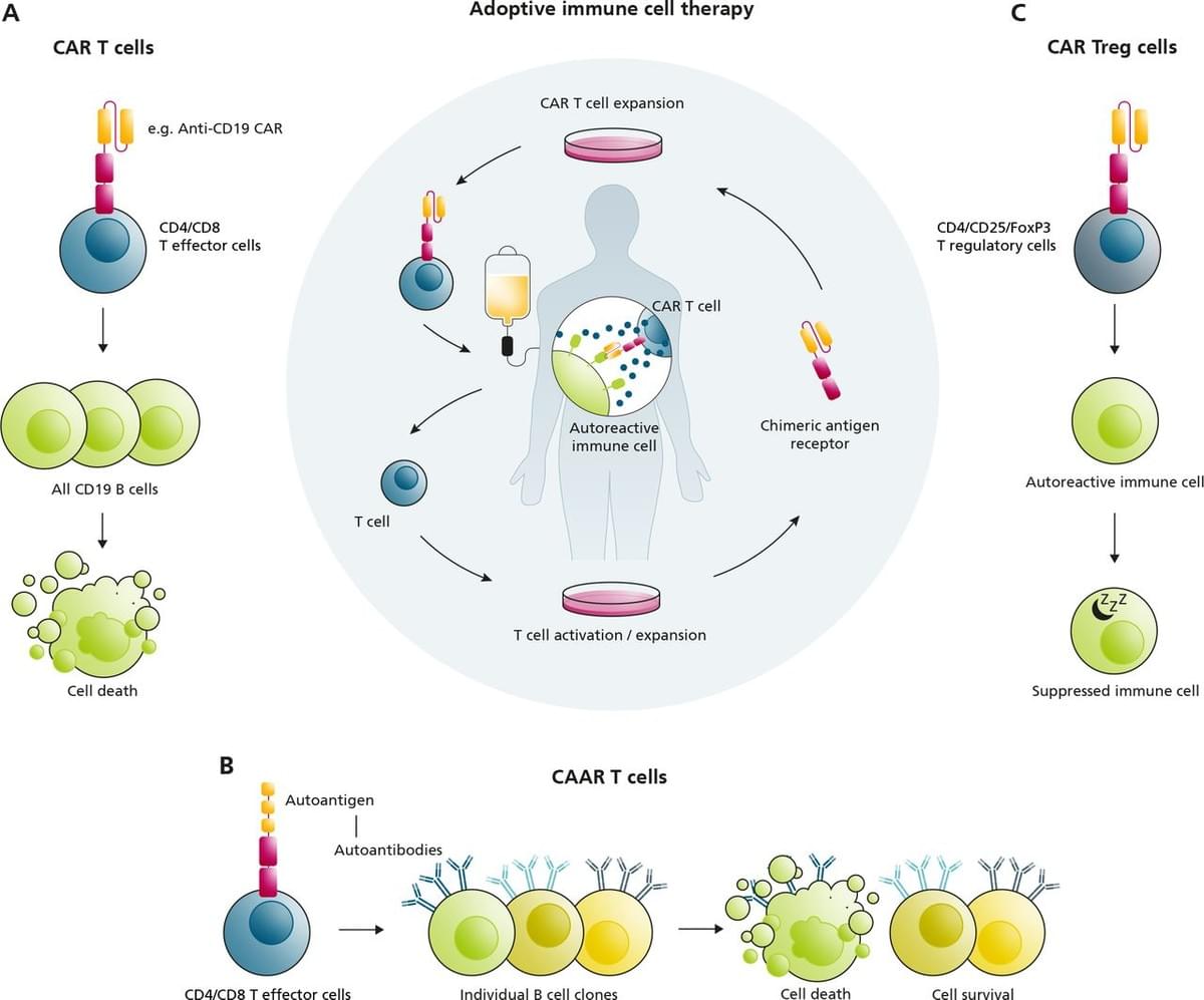 (A) We can use CAR-T cells specifically targeting B cell markers (such as CD19) to eliminate the "bad B cells" that attack the body's own tissues, thereby achieving broad-scale clearance of pathogenic B cells. (B) To make this elimination more precise and avoid "killing innocent cells," scientists have developed a precision targeting technology that specifically targets only those particular pathogenic B cells that produce autoantibodies and truly cause disease. This technology is called CAAR-T cells (Chimeric Autoantibody Receptor T cells). (C) In addition to directly eliminating "bad cells," there's another approach: instead of killing them, we make them behave and quiet down. This involves using CAR-modified regulatory T cells (Tregs) to suppress abnormal immune activity. Blache U, Tretbar S, Koehl U, Mougiakakos D, Fricke S. CAR T cells for treating autoimmune diseases. RMD Open. 2023;9:e002907. https://doi.org/10.1136/rmdopen-2022-002907