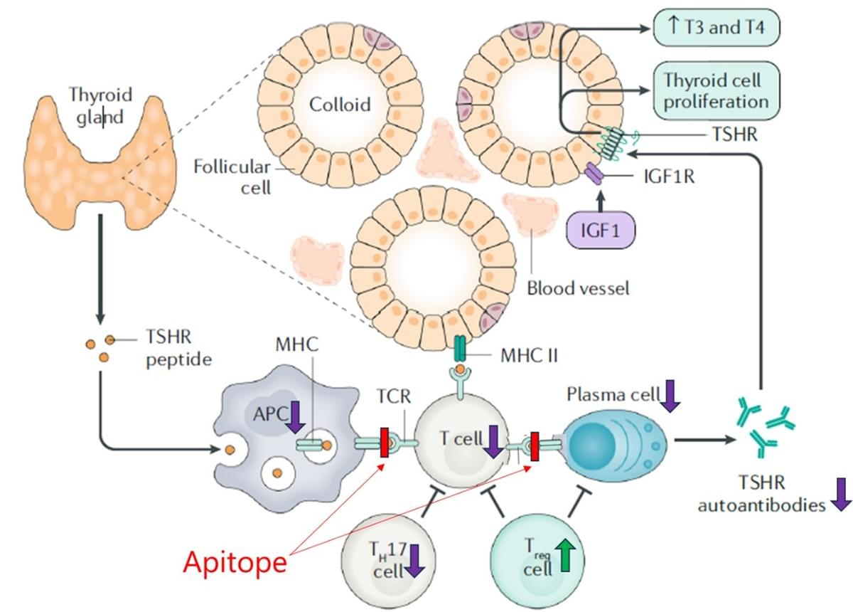 TSAb (Thyroid Stimulating Antibodies): TSAb are autoantibodies produced by the immune system that stimulate the TSHR. In Graves’ disease and TED, TSAb bind to TSHR on thyroid cells and orbital fibroblasts, activating them. This activation causes overproduction of thyroid hormones and stimulates fibroblasts in the orbit to proliferate and produce substances causing inflammation and swelling. The action of TSAb is like an overenthusiastic messenger pushing TSHR to work overtime, which contributes to the eye symptoms in TED. TSAb (Thyroid Stimulating Antibodies): TSAb are autoantibodies produced by the immune system that stimulate the TSHR. In Graves’ disease and TED, TSAb bind to TSHR on thyroid cells and orbital fibroblasts, activating them. This activation causes overproduction of thyroid hormones and stimulates fibroblasts in the orbit to proliferate and produce substances causing inflammation and swelling. The action of TSAb is like an overenthusiastic messenger pushing TSHR to work overtime, which contributes to the eye symptoms in TED.