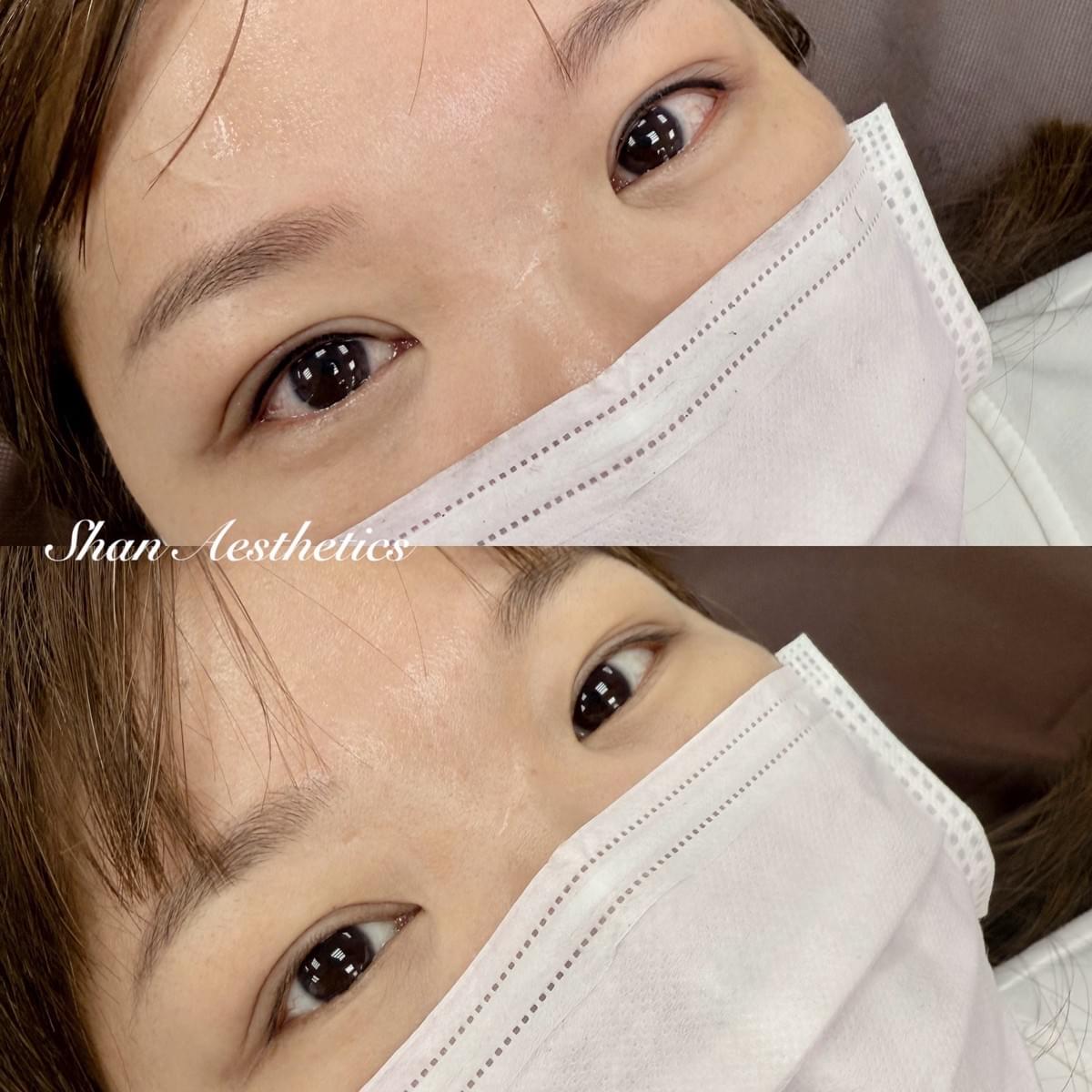 自然上眼線