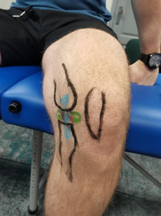 Join our courses and workshops to gain knowledge that will help you in the fight against pain and improve the quality of life of your patients. Discover New Possibilities in Manual Therapy courses, workshops, training in the fight against pain manual therapy