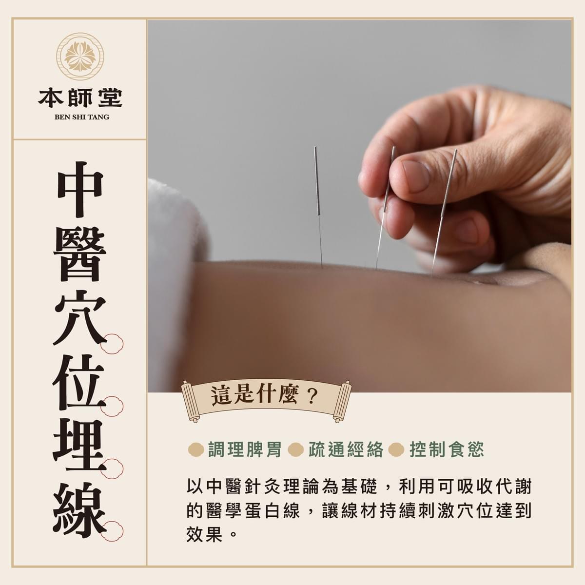 本師堂中醫穴位埋線介紹