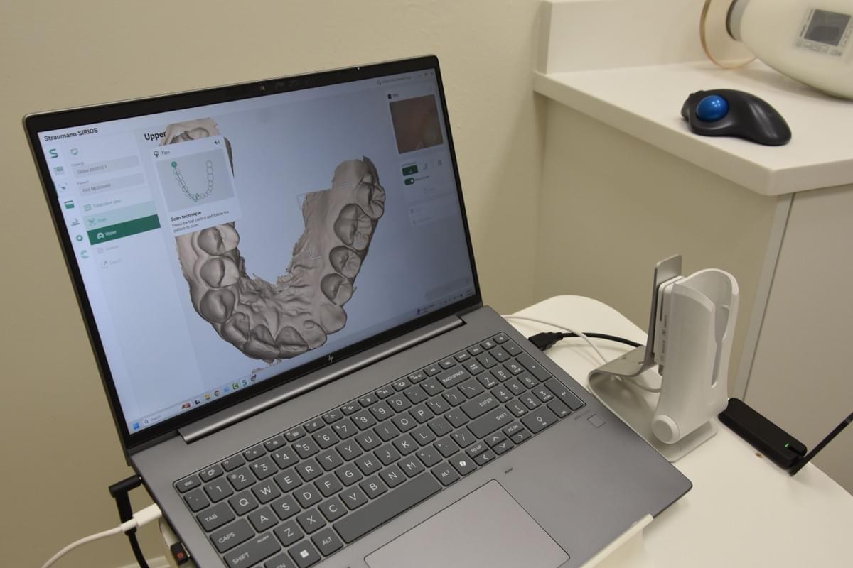 Digital Dentistry Scanning
