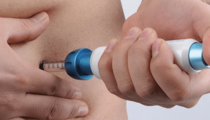 How Work Needle Free Injection What are needle-free injections?