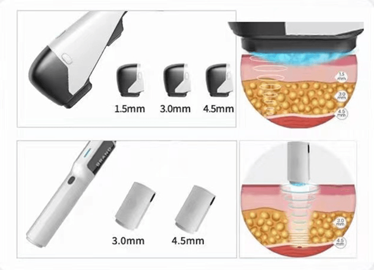 Cryo HIFU 2 in 1 Skin Care System