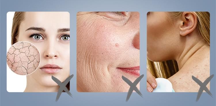 Portable Mesotherapy Skin Care System