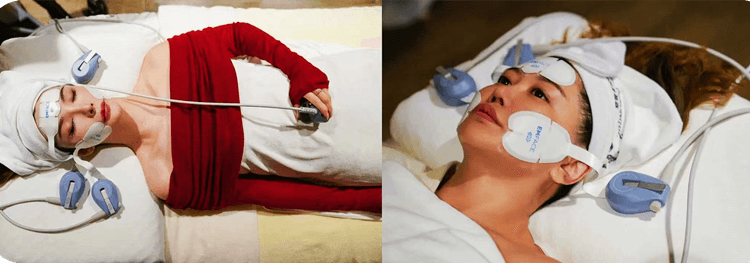 High-intensity Facial Electromagnetic Stimulation System EMFACE