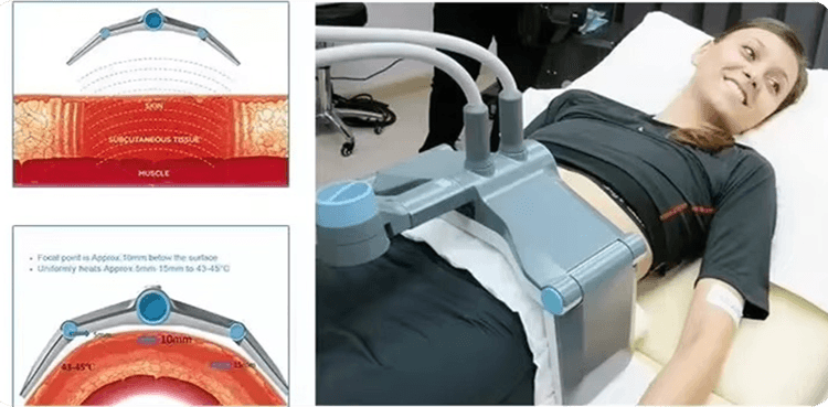 VANQUISH ME Body Care System