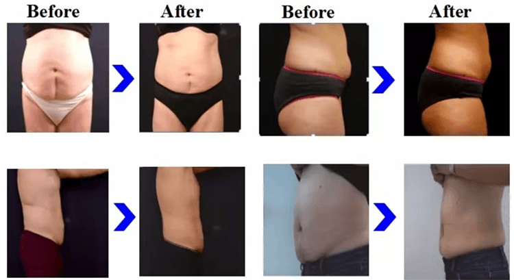 VANQUISH ME Body Care System