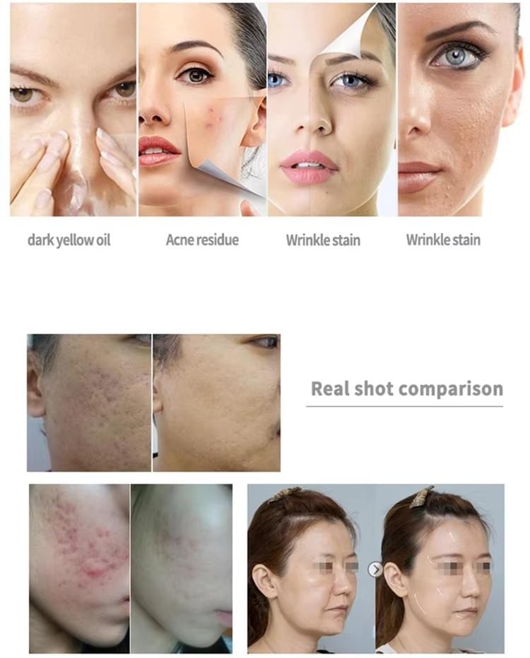 Portable Oxygen Bubble Skin Care System