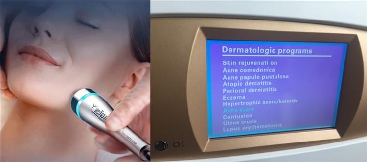 Local Dynamic Micro-massage System LDM