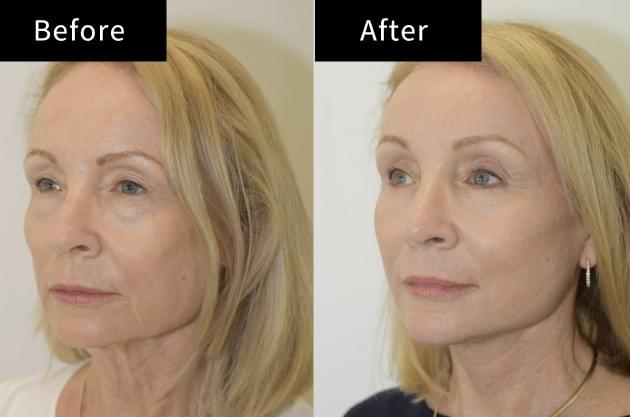 Want to enhance your curves or achieve a slimmer silhouette? From breast augmentation to body contouring, our treatments help you reach your aesthetic goals safely. We use the latest techniques to ensure minimal downtime and maximum satisfaction. Breast & Body Contouring Our Cosmetic Surgery Services 主要做整形手术