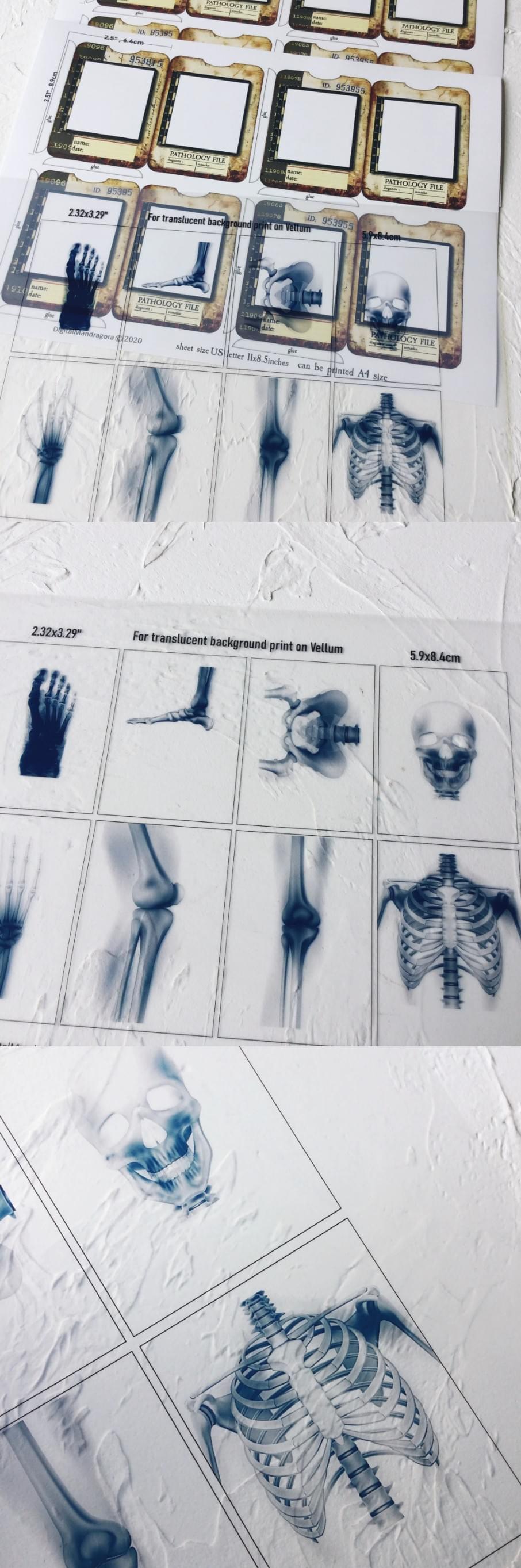 Vintage Dark X-Ray Film Transparencies (11-20)