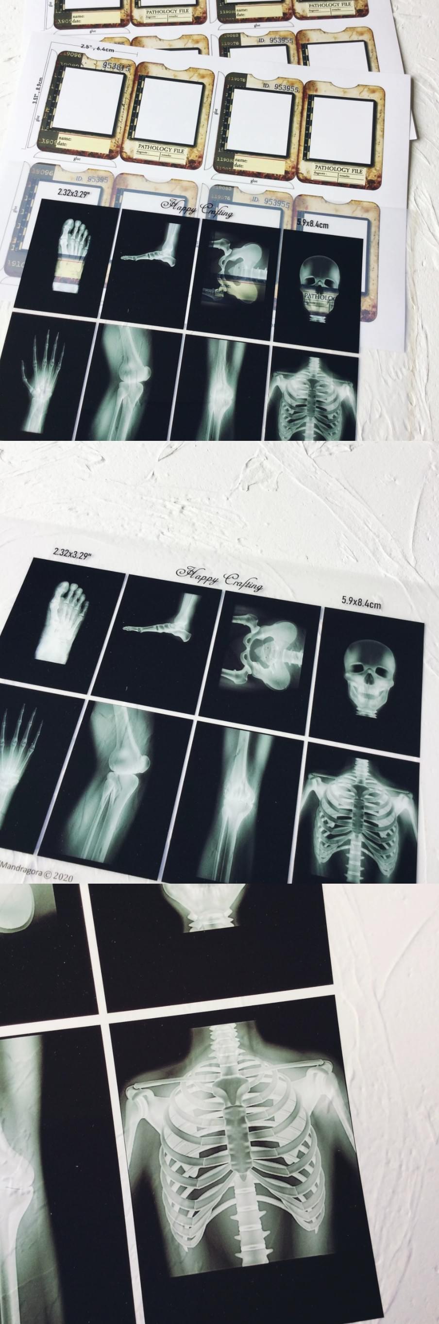 Vintage Dark X-Ray Film Transparencies (11-20)