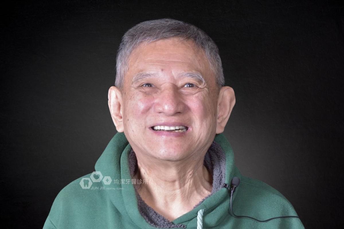 均潔牙醫診所，數位導引植牙案例