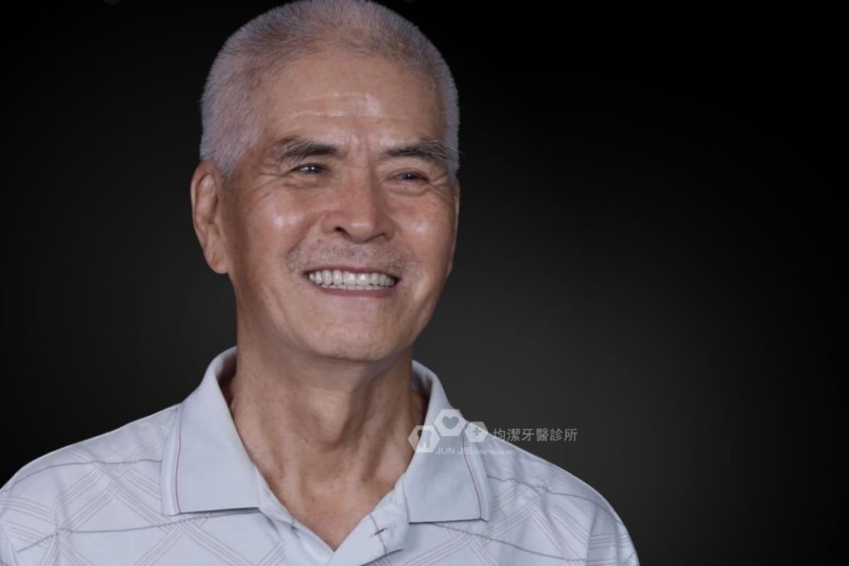 均潔牙醫診所，數位導引植牙案例