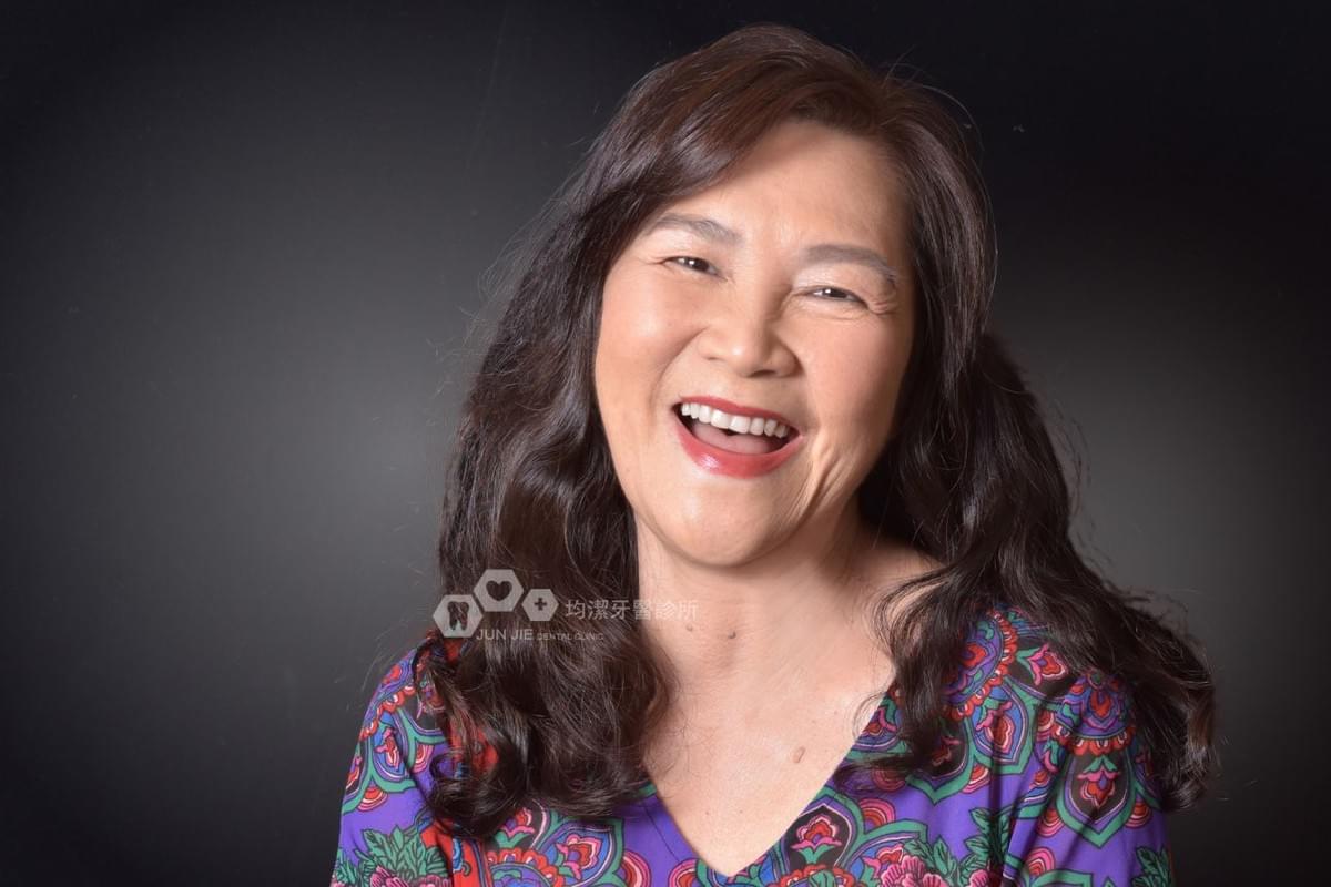 均潔牙醫診所，All on 4植牙案例