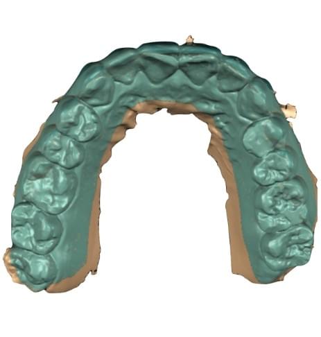 中和均潔牙醫診所-全口設計方案