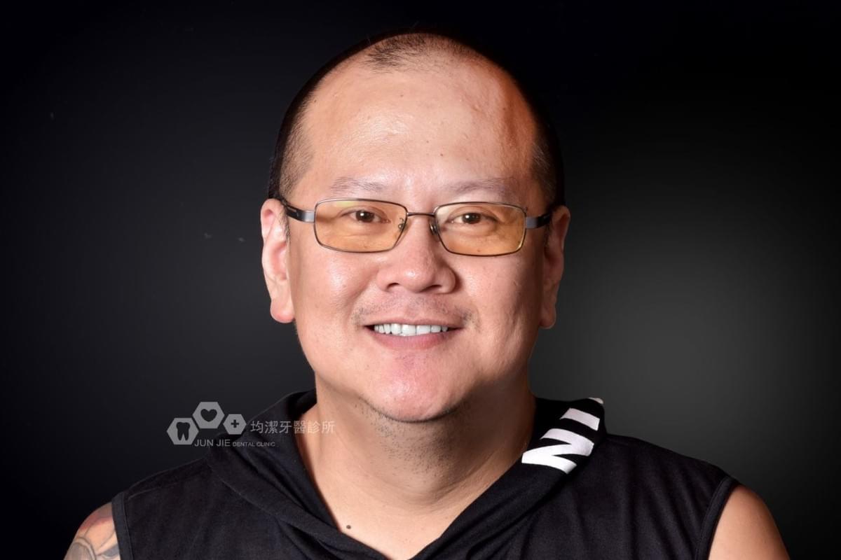 均潔牙醫診所，All on 4植牙案例