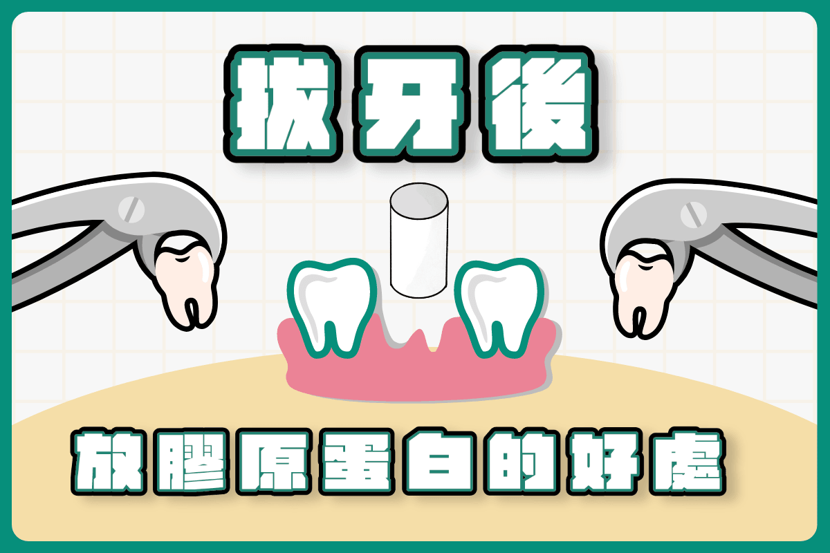 膠原蛋白是什麼?