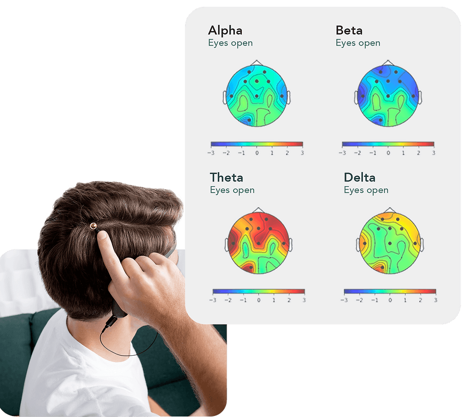 Brain & Neuro System Treatment Brain Training Neurofeedback and Matrix Matrix Repatterning