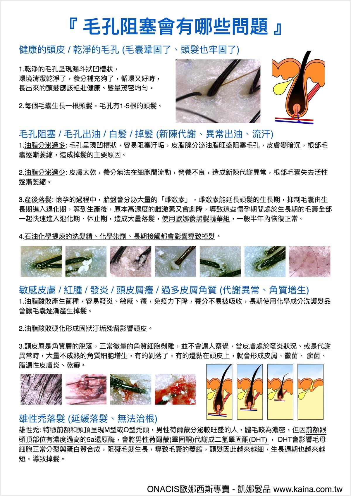 ONACIS 歐娜西斯｜頭皮屑平衡精華 180ml (按押瓶)