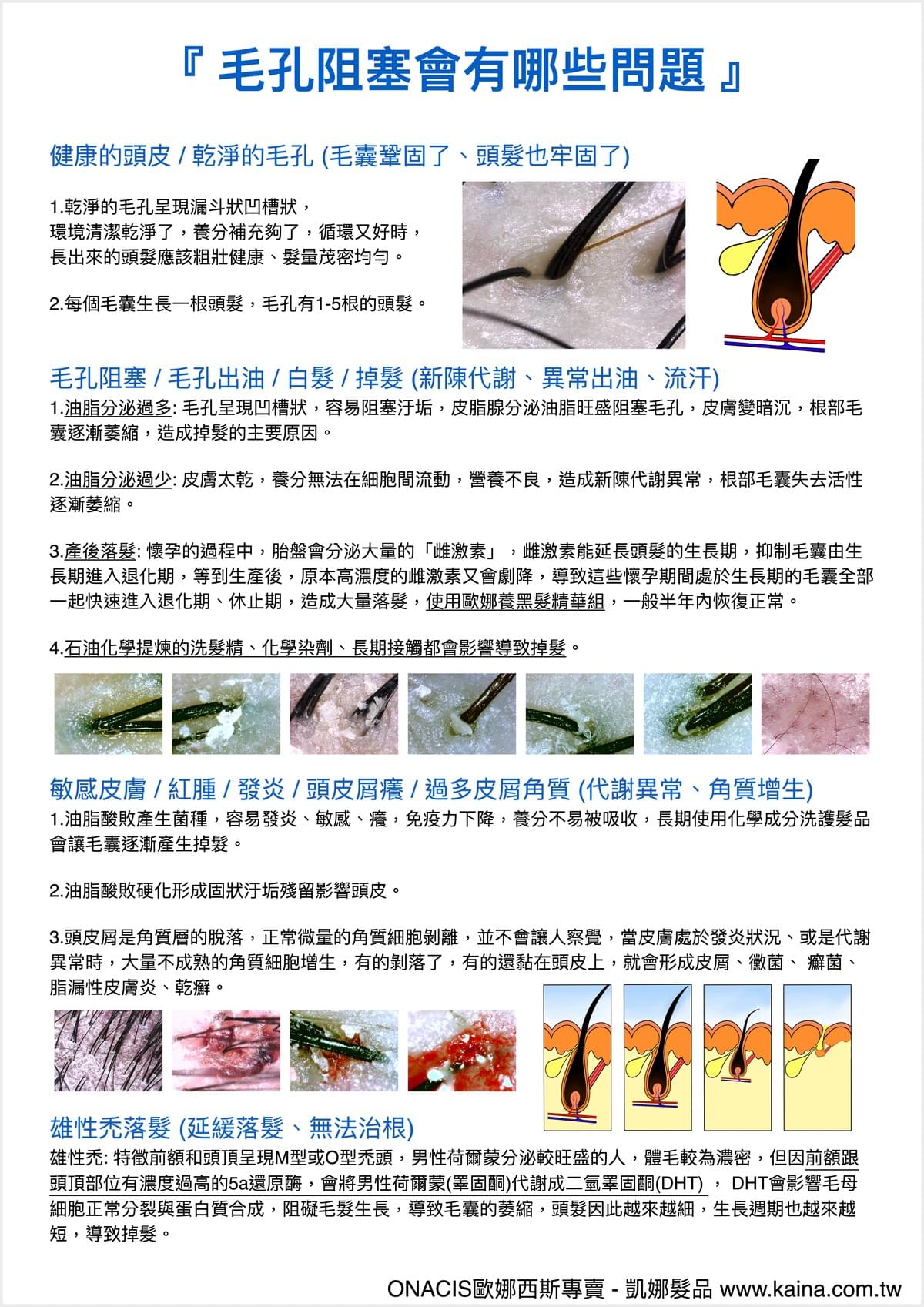 ONACIS 歐娜西斯｜油性 毛孔平衡精華 180ml (噴霧瓶)