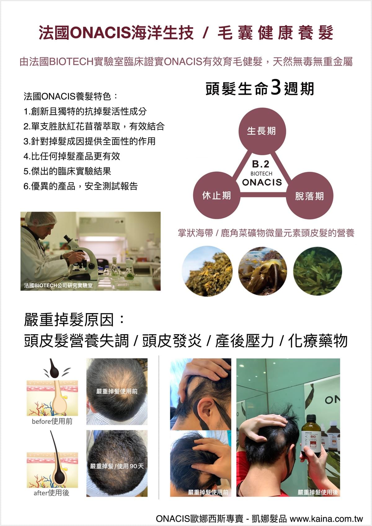 ONACIS 歐娜西斯｜頭髮營養精華/嚴重掉髮專用250ml（贈50ml）