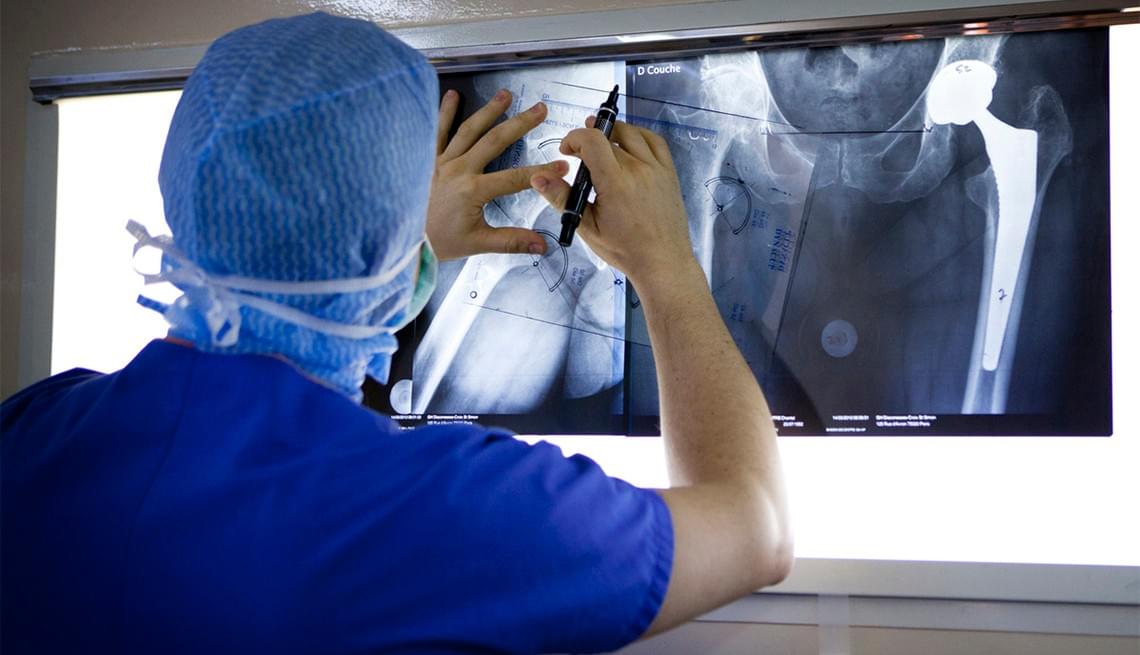 When Can You Have Hip Replacement Surgery?
