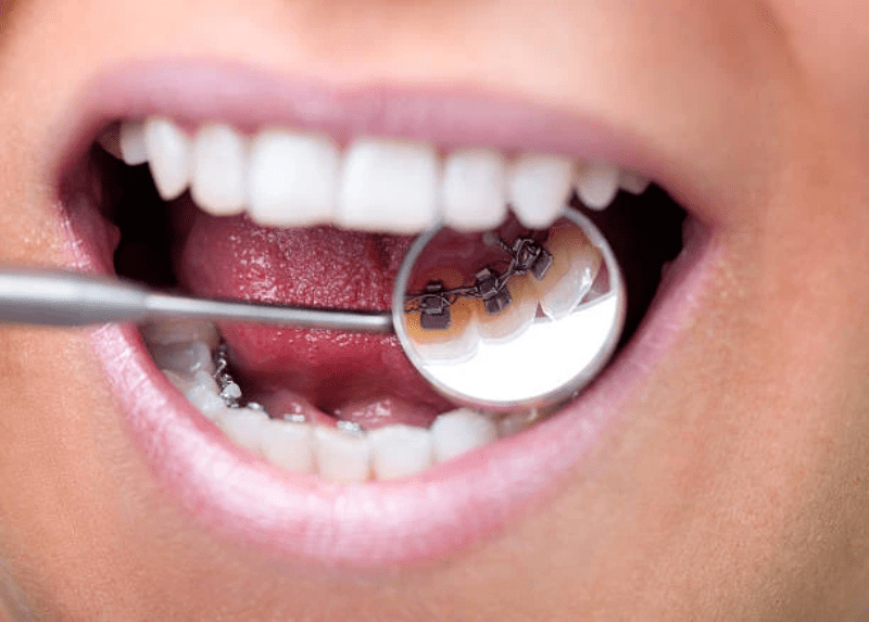 Smart Orthodontics What Does It Mean?