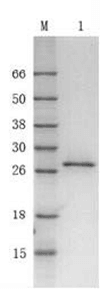 Recombinant Streptococcus Protein G (r-SPG)