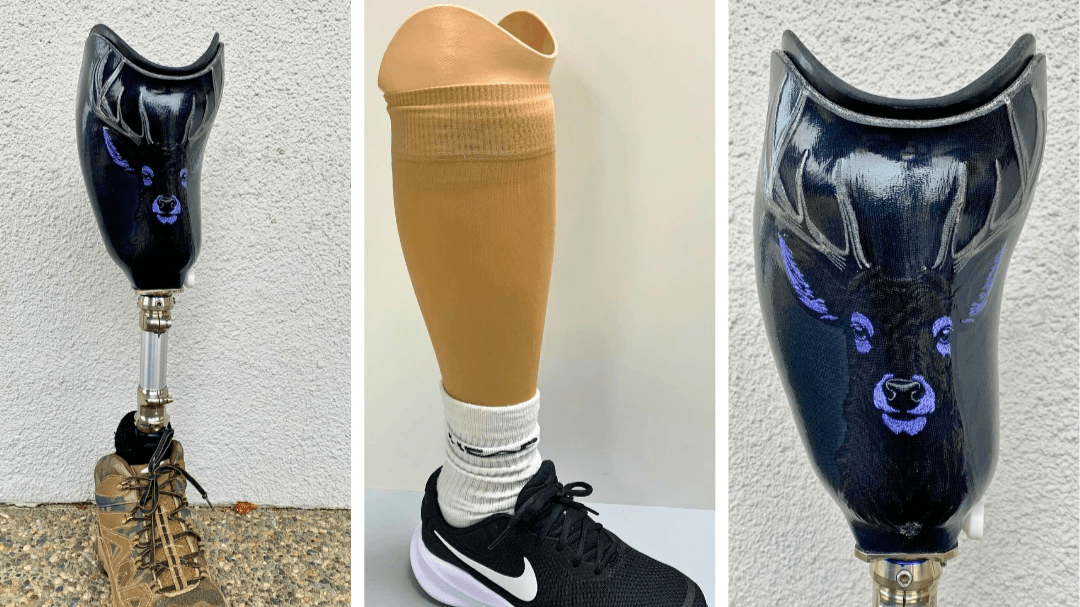 artful-prosthetic-creations