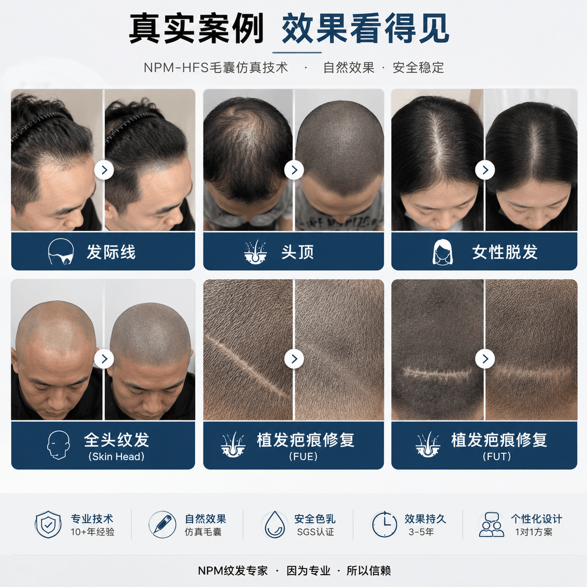 涵盖发际线调整、头顶加密、女性脱发、全头纹发及植发疤痕修复等不同脱发类型，展示真实改善效果与视觉密度提升方案。