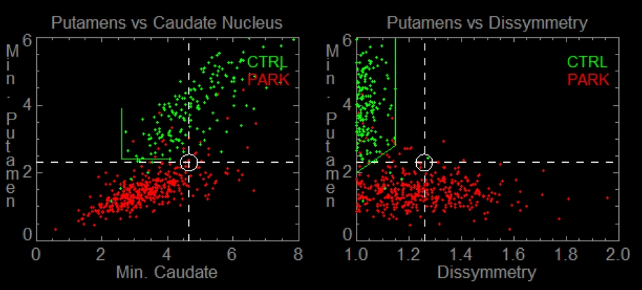 En - DaTscan quantification software