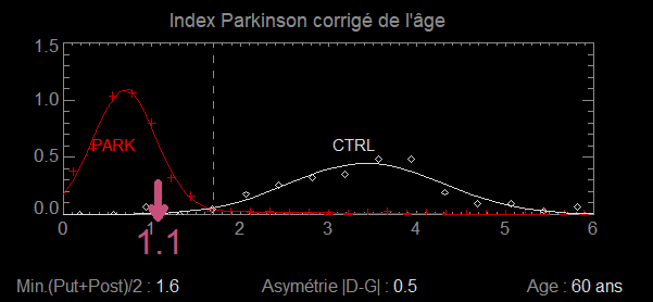DaTscan quantification software