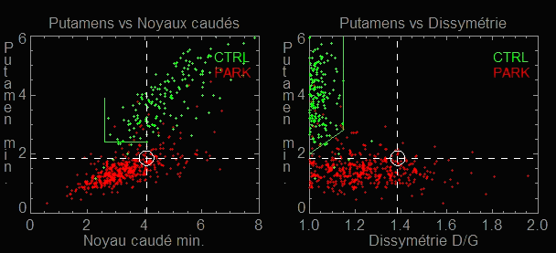 DaTscan quantification software