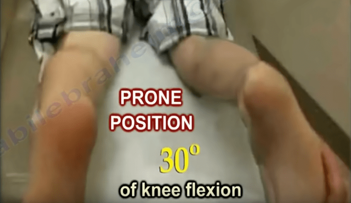 The Dial Test - Knee Knee Injury Nabil Orthopedics Heal...