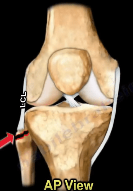 The Dial Test - Knee Knee Injury Nabil Orthopedics Heal...
