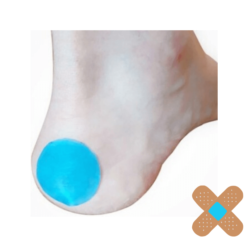 Ampoule au Pied Comment traiter et soigner AMPOULE PI...