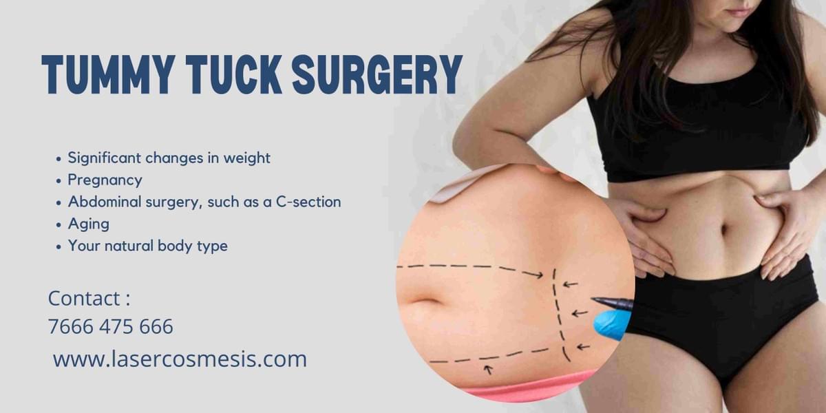 Benefits of a Tummy Tuck After a CSection tummytuck...