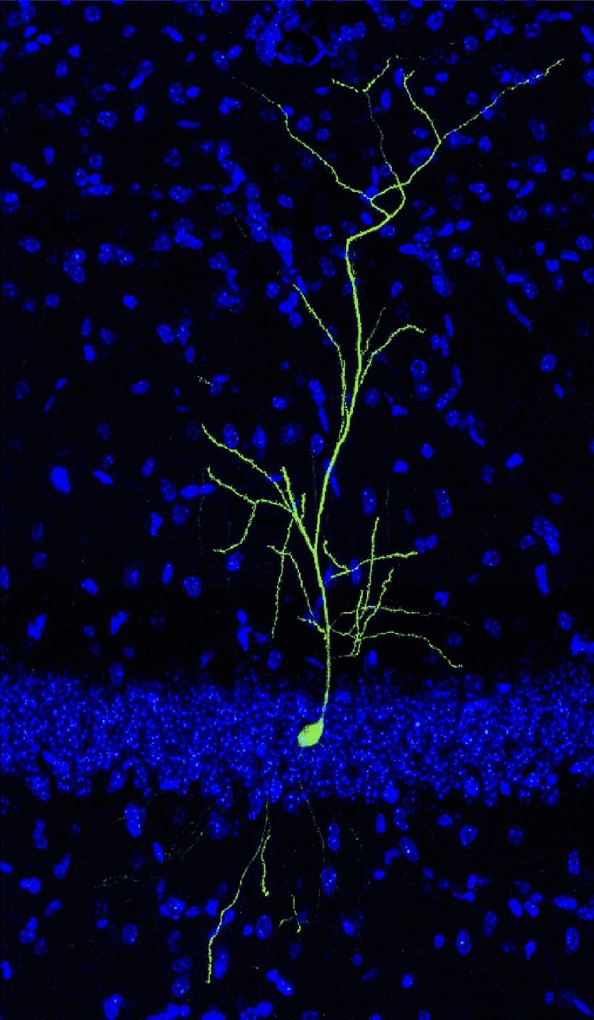 OUR VISION Xinyu Zhao Neuroscience Laboratory At Tsinghua University 