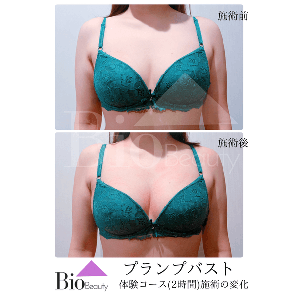 プランプバスト 体験コース（2時間）施術の変化
