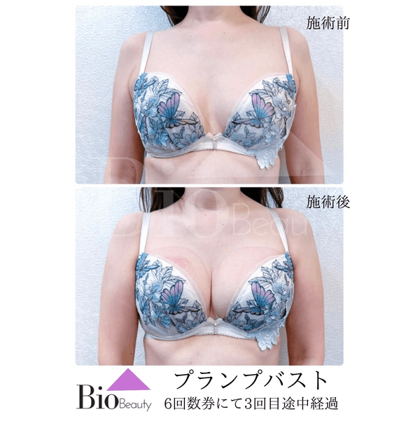 プランプバスト 6回数券にて3回目途中経過